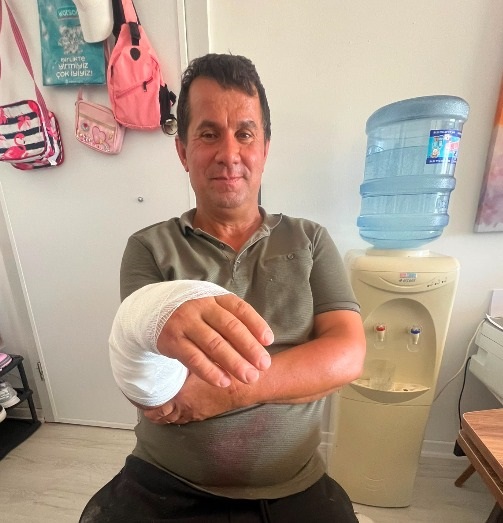 Marmaris’te Sivas kangalı adamın kolunu parçaladı